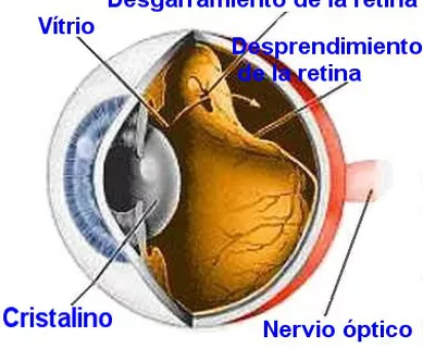 Dermatocalasia antes